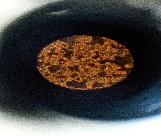 Mycoplasma Contamination